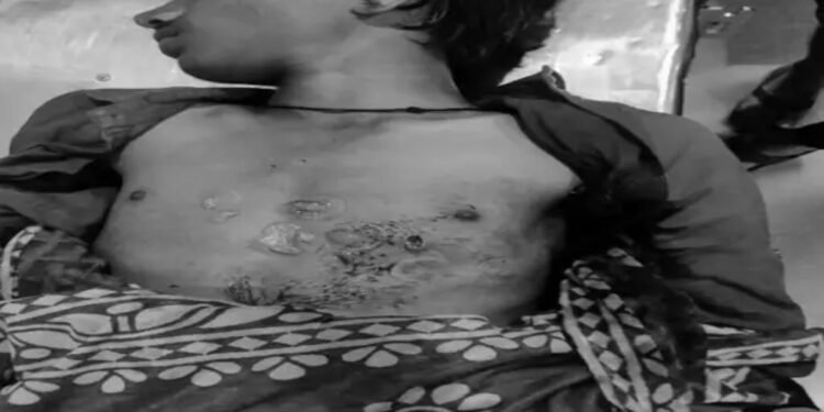 रायपुर में 9वीं के छात्र की चाकू मारकर हत्या: हेयर स्टाइल पर कमेंट किया तो सीने पर किए ताबड़तोड़ वार; हिरासत में नाबालिग दोस्त